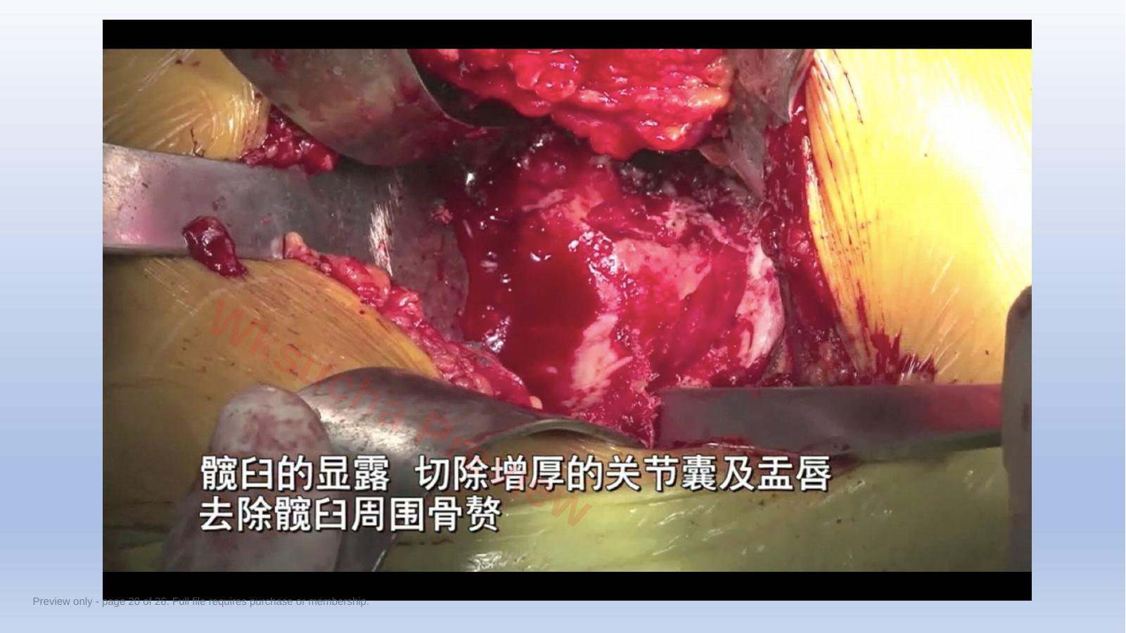 预览第 20 页
