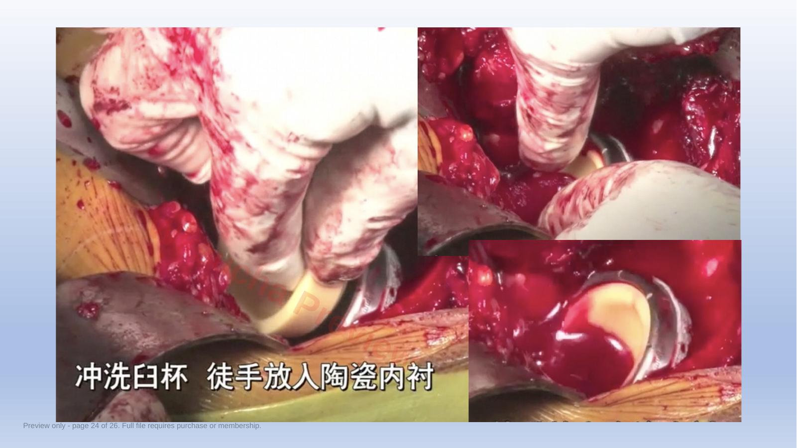 预览第 24 页