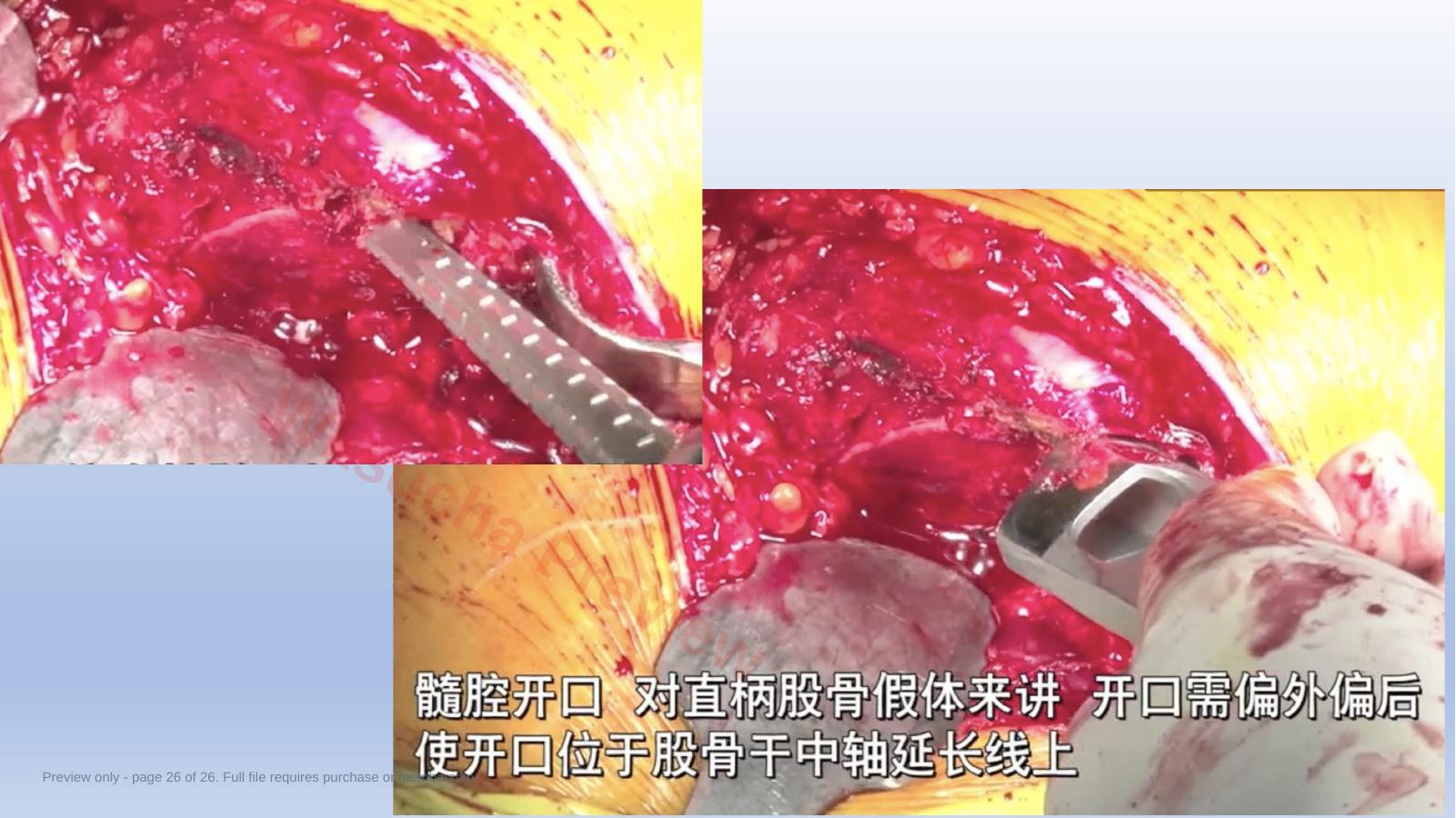 预览第 26 页