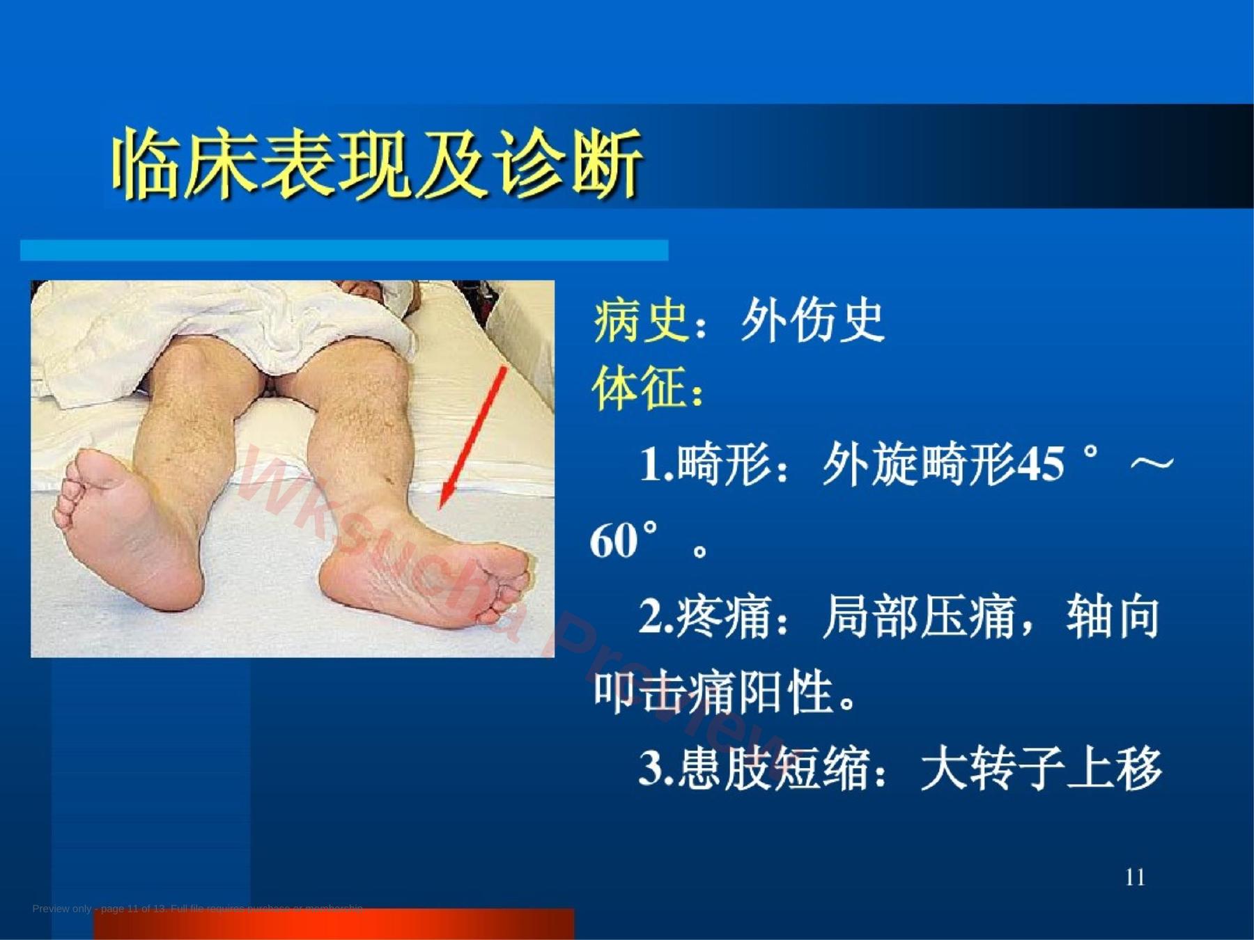 预览第 11 页