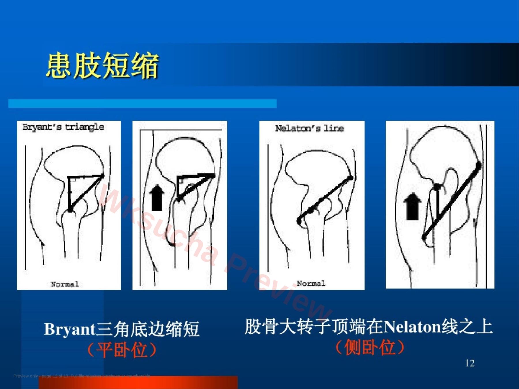 预览第 12 页