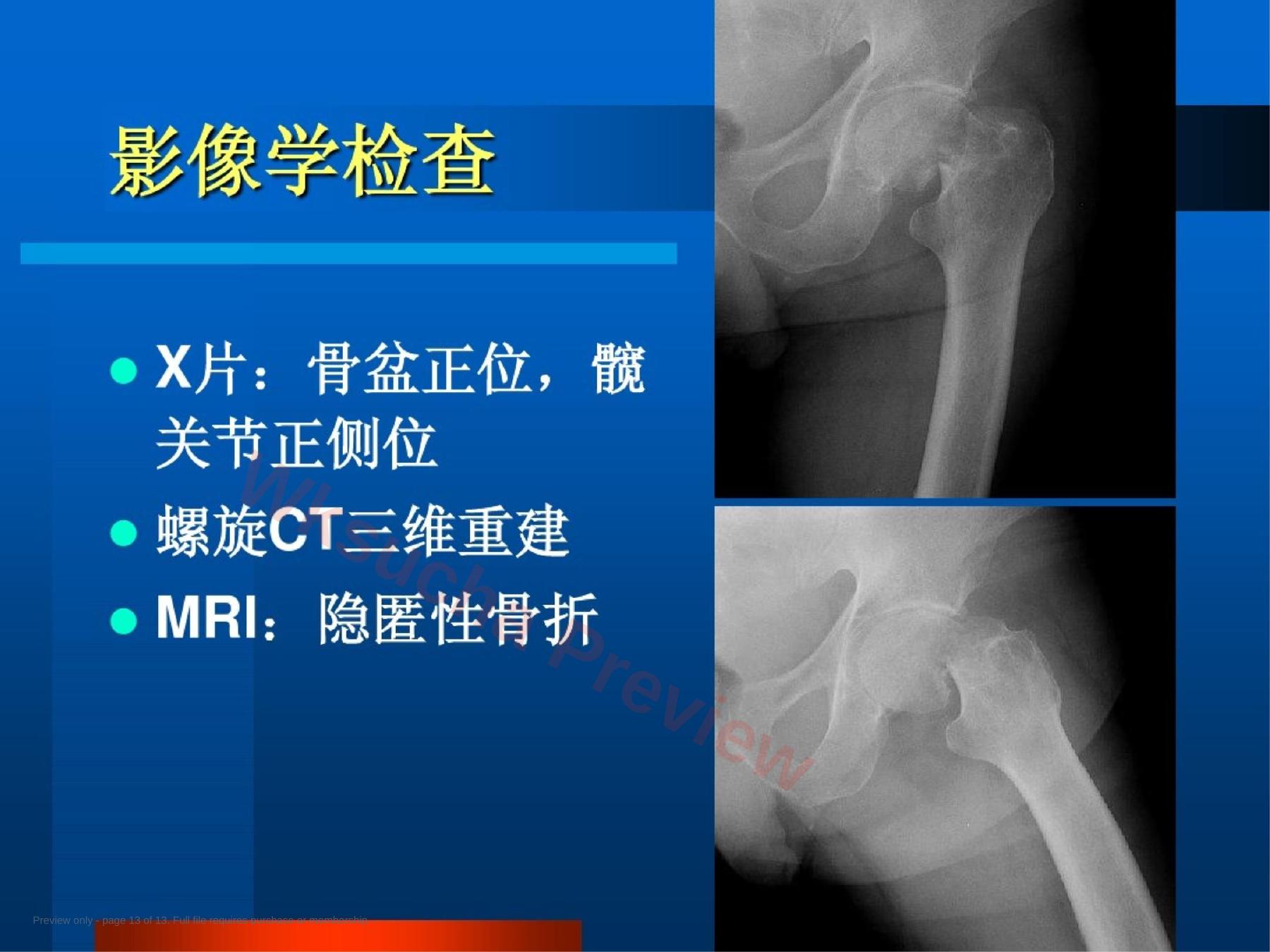 预览第 13 页