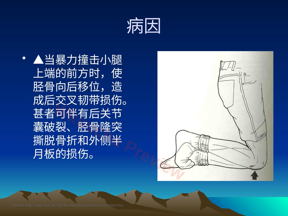 预览第 5 页