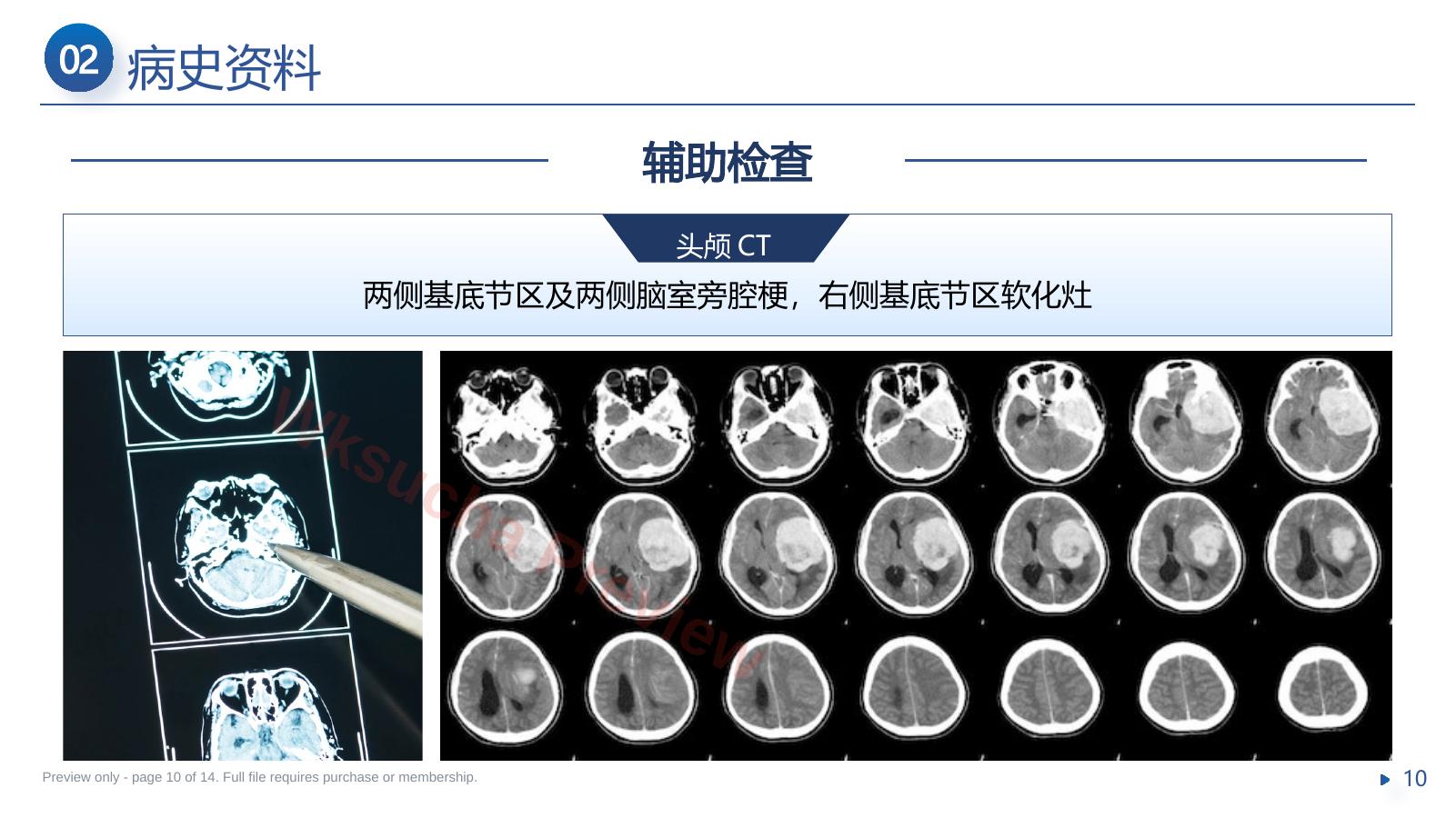 预览第 10 页