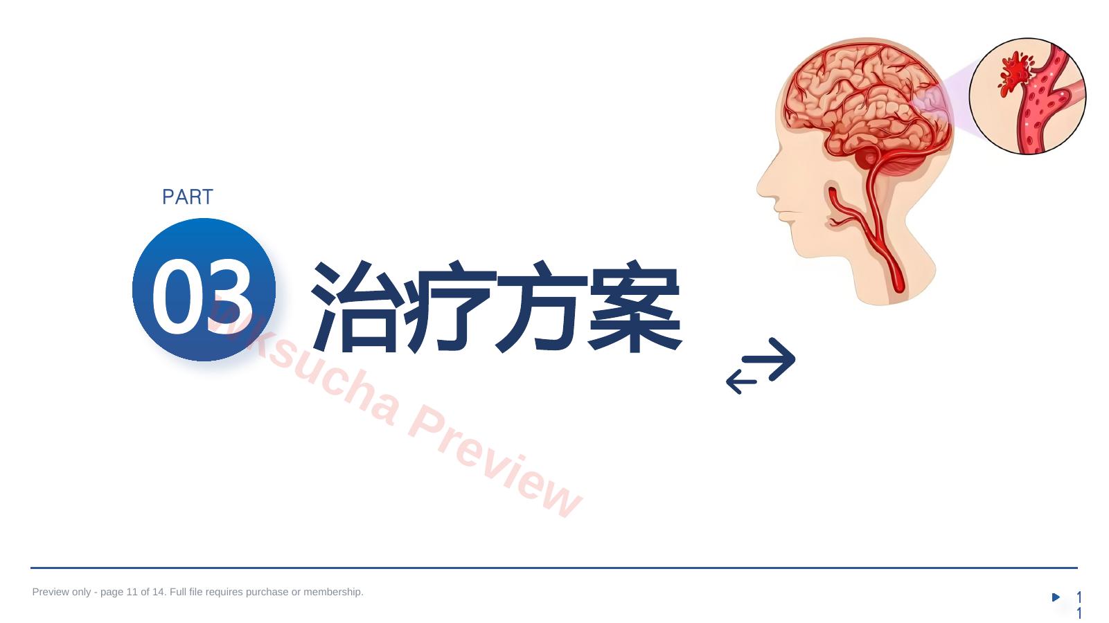 预览第 11 页