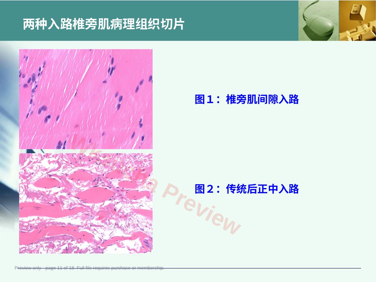 预览第 11 页