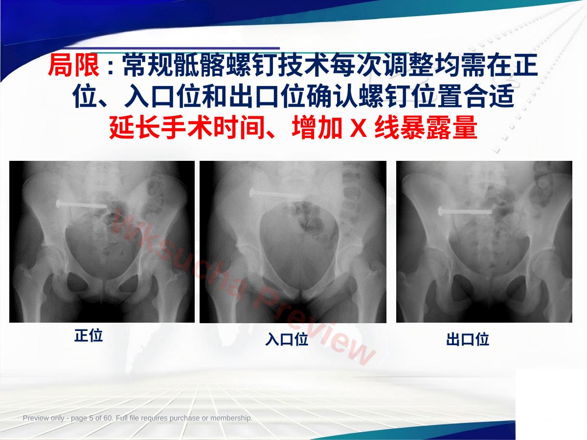 预览第 5 页