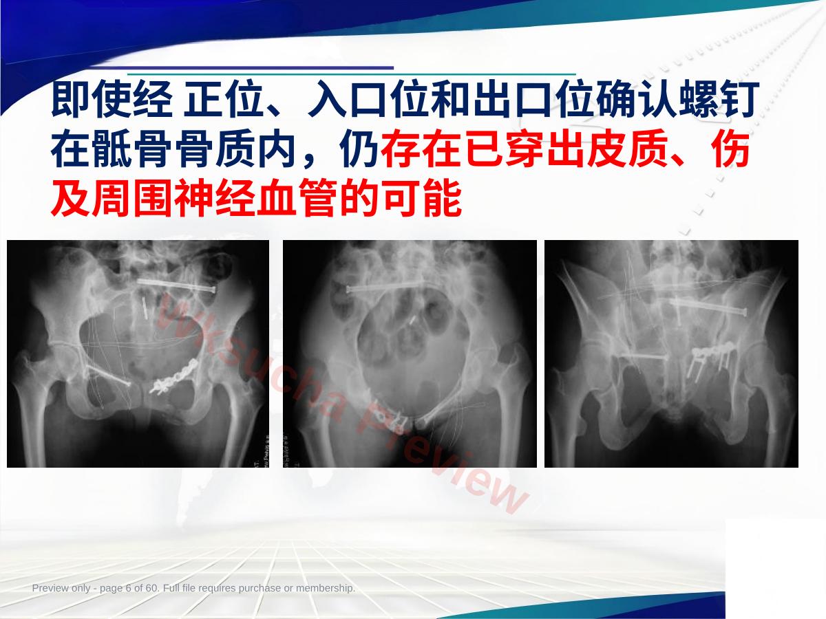 预览第 6 页