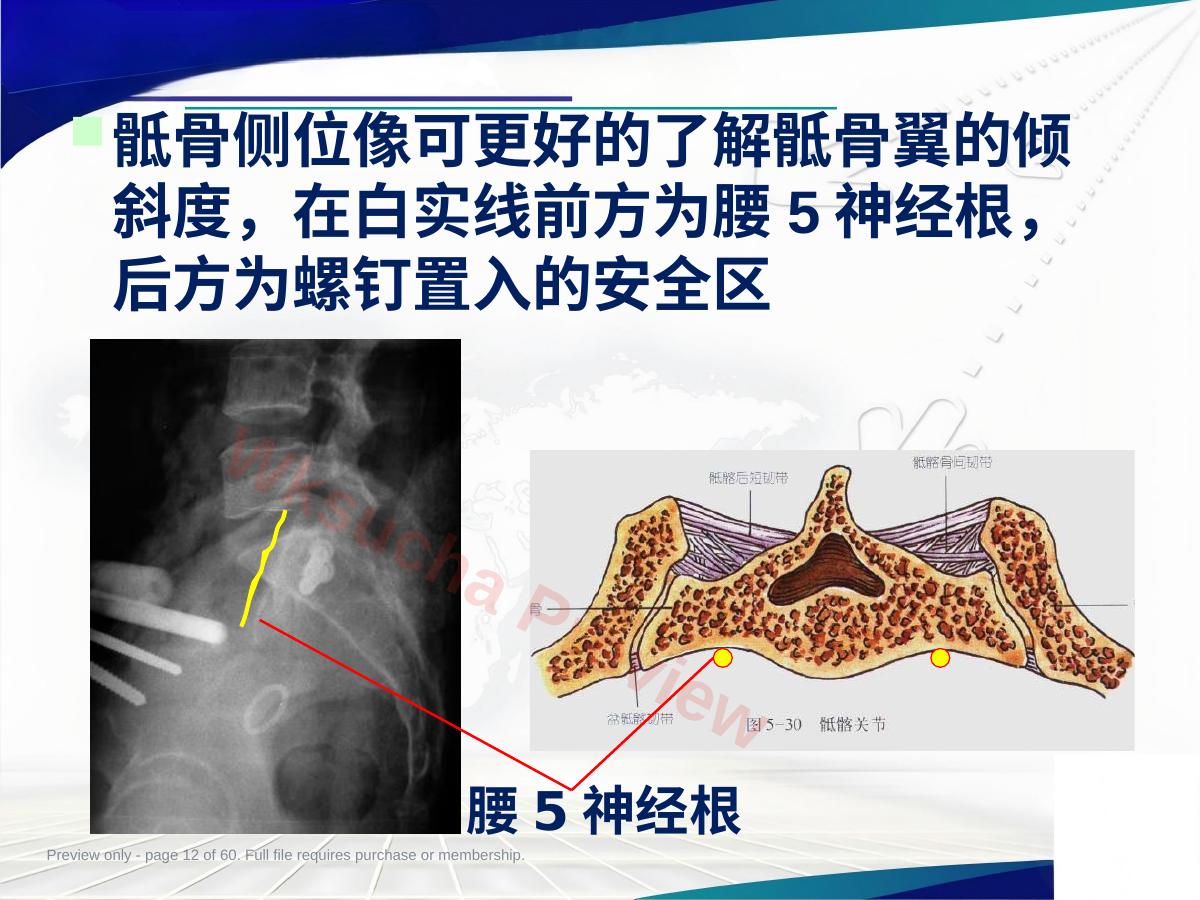 预览第 12 页