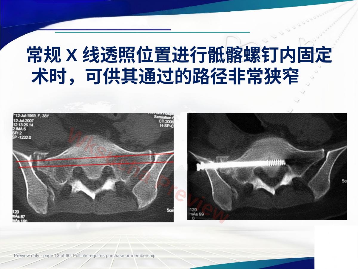预览第 13 页