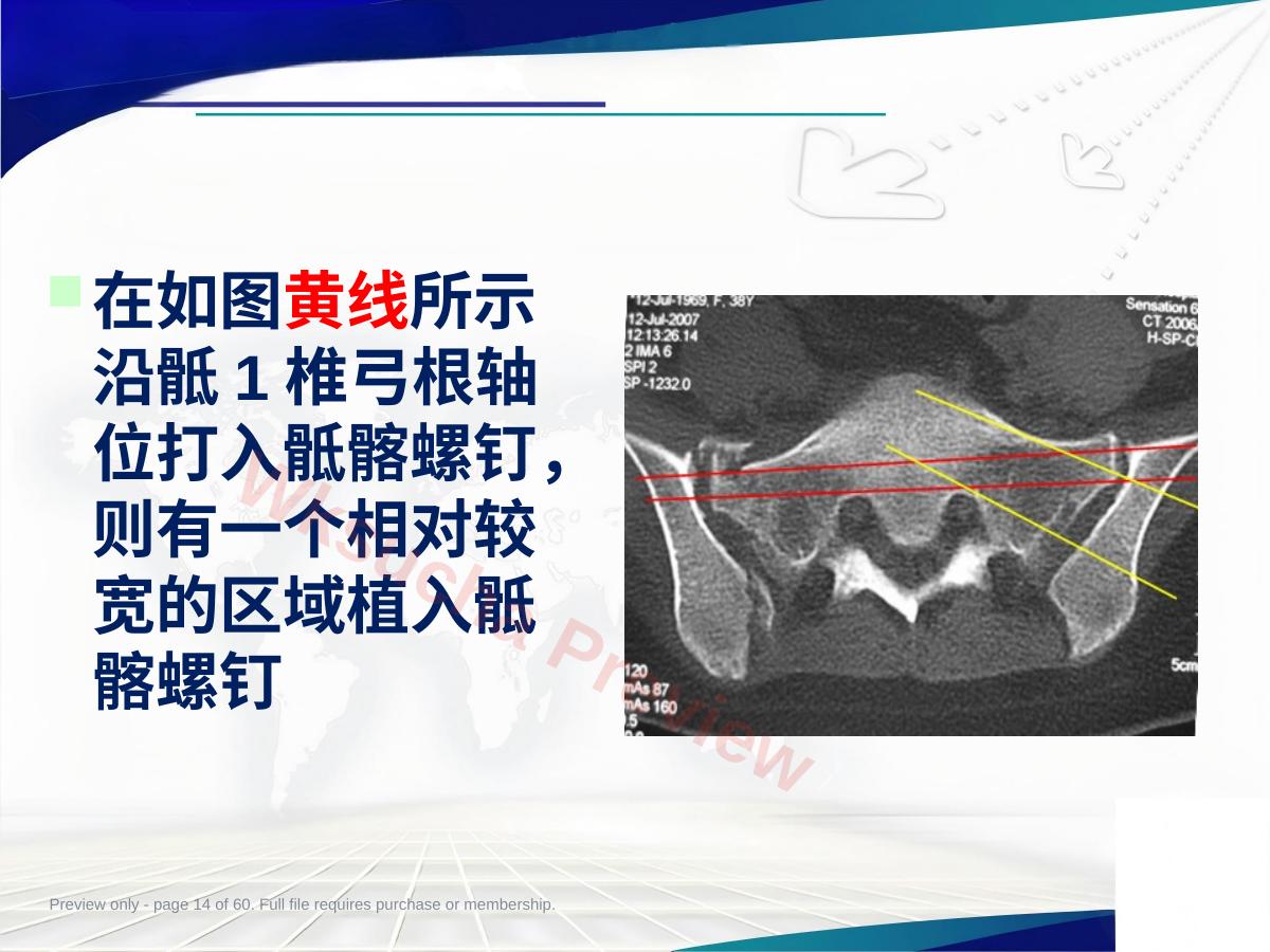 预览第 14 页