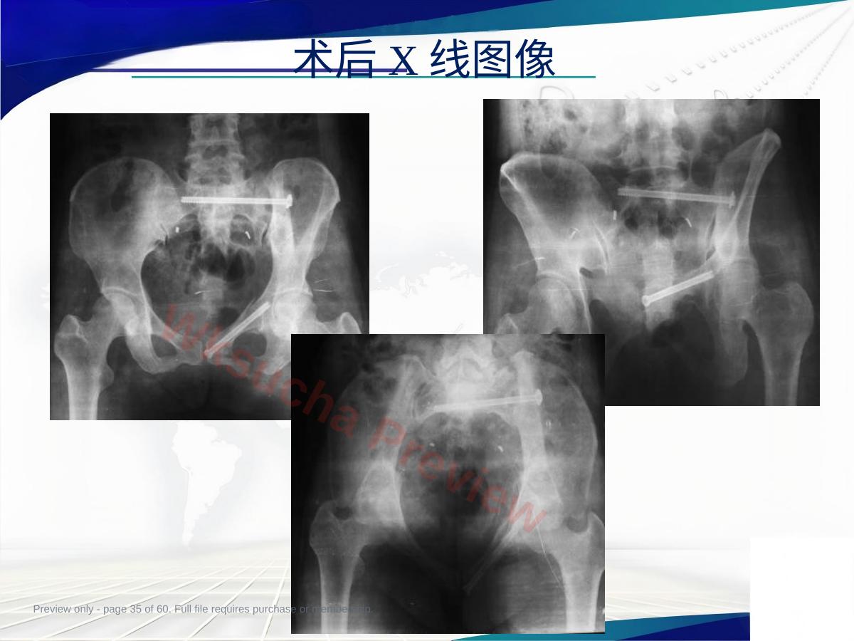 预览第 35 页