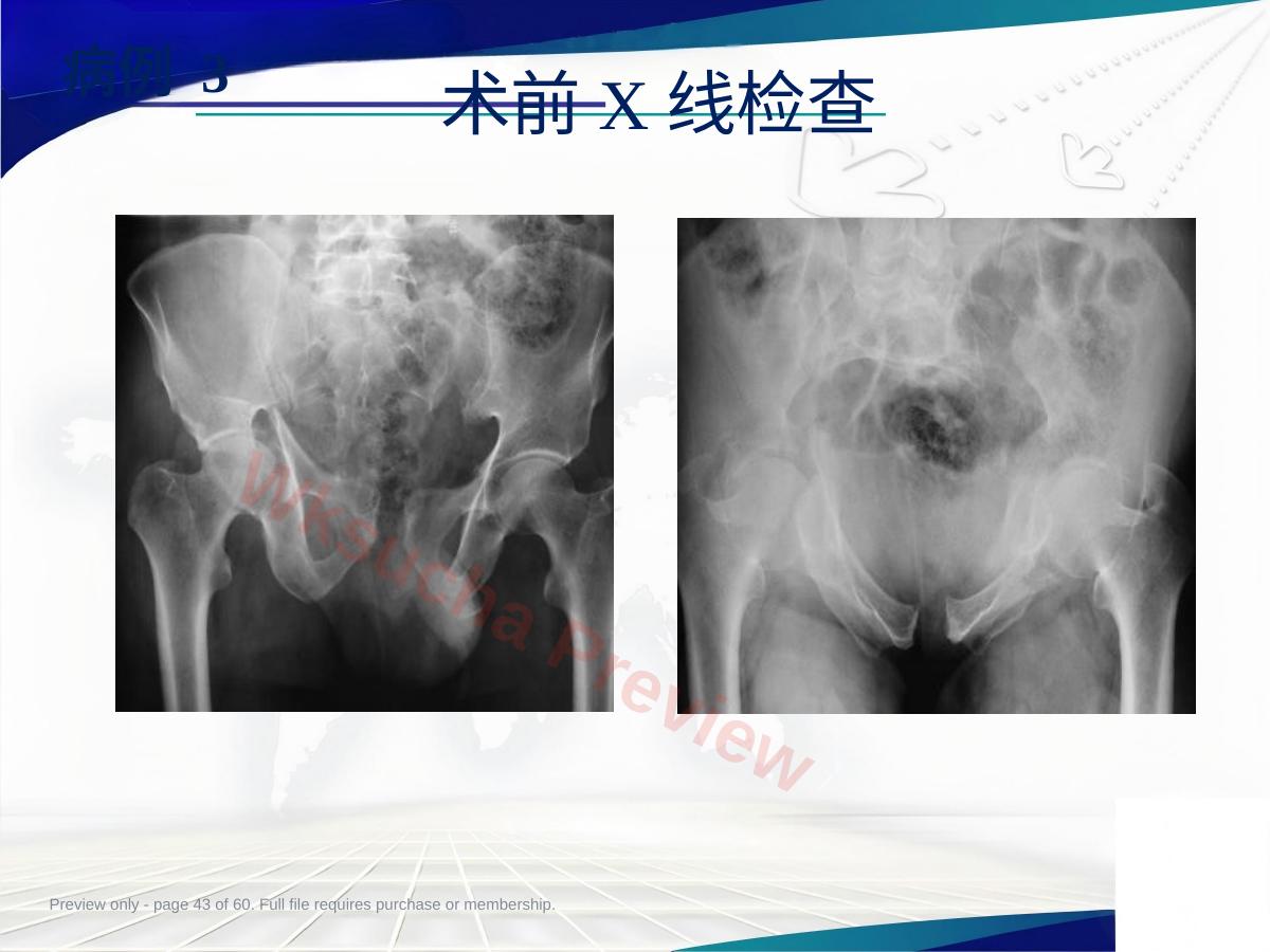 预览第 43 页