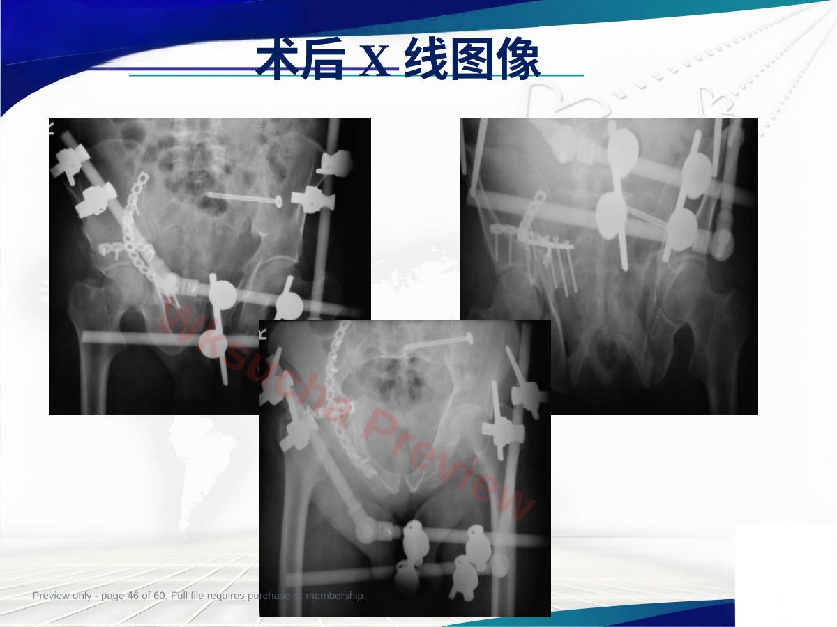 预览第 46 页