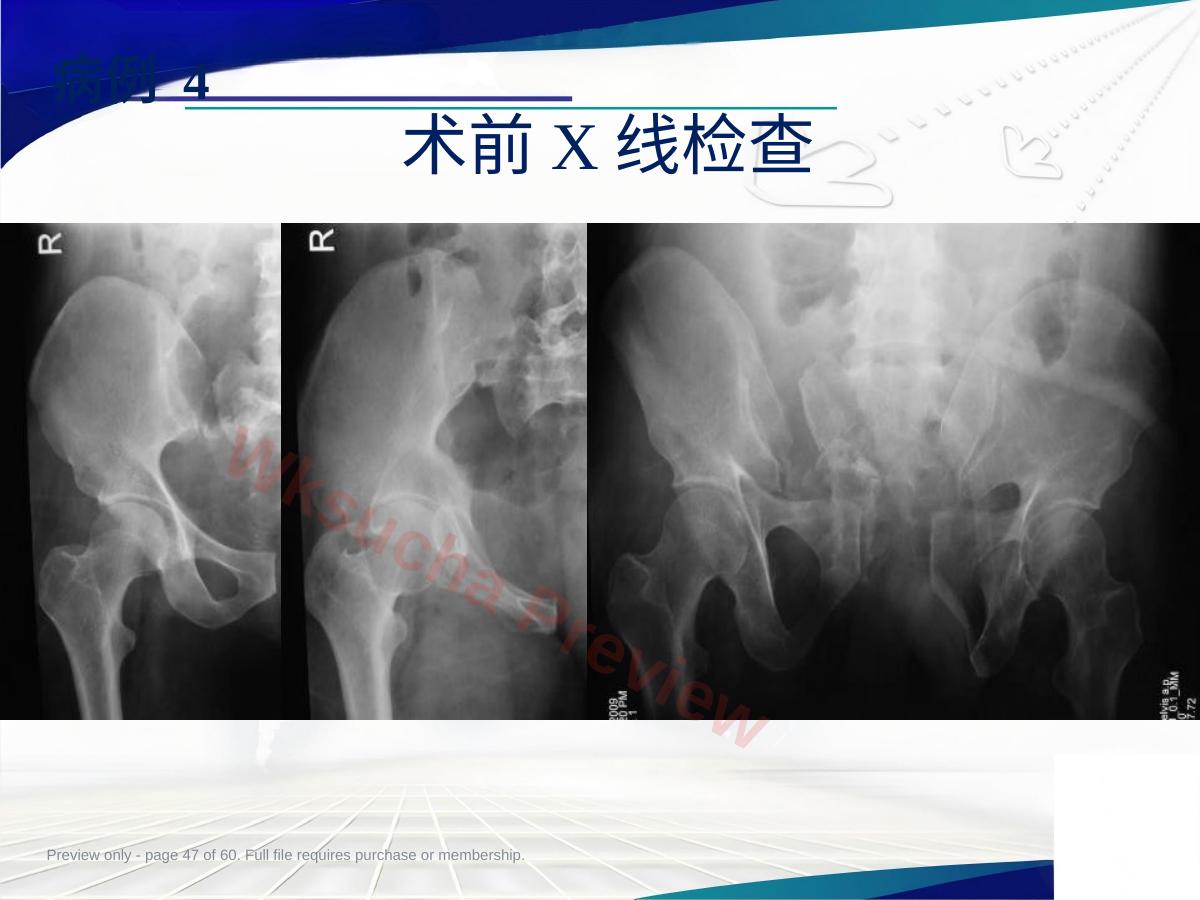 预览第 47 页