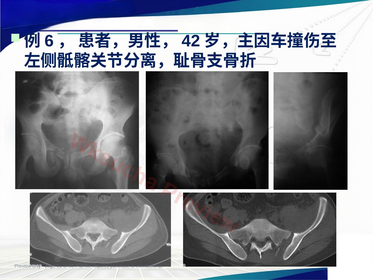 预览第 51 页