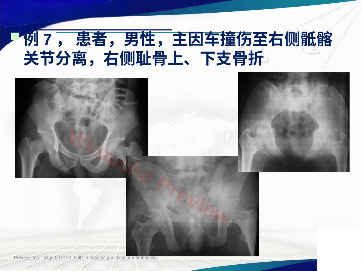 预览第 53 页