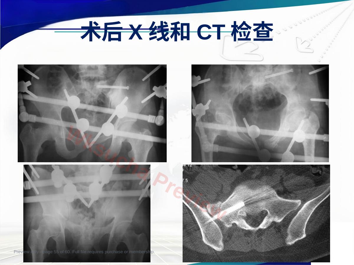 预览第 55 页