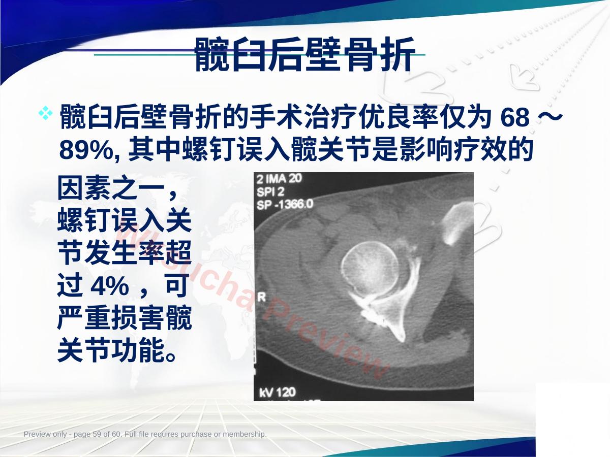 预览第 59 页