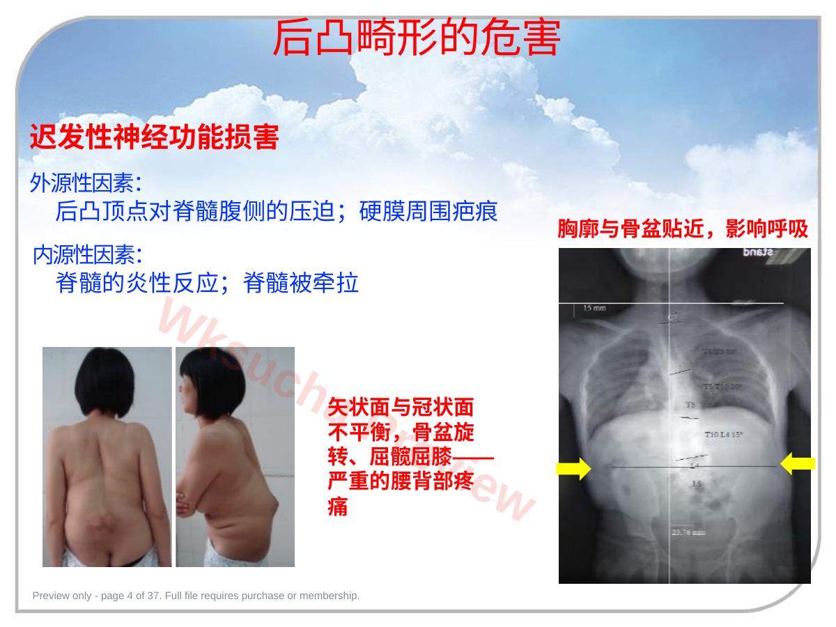 预览第 4 页