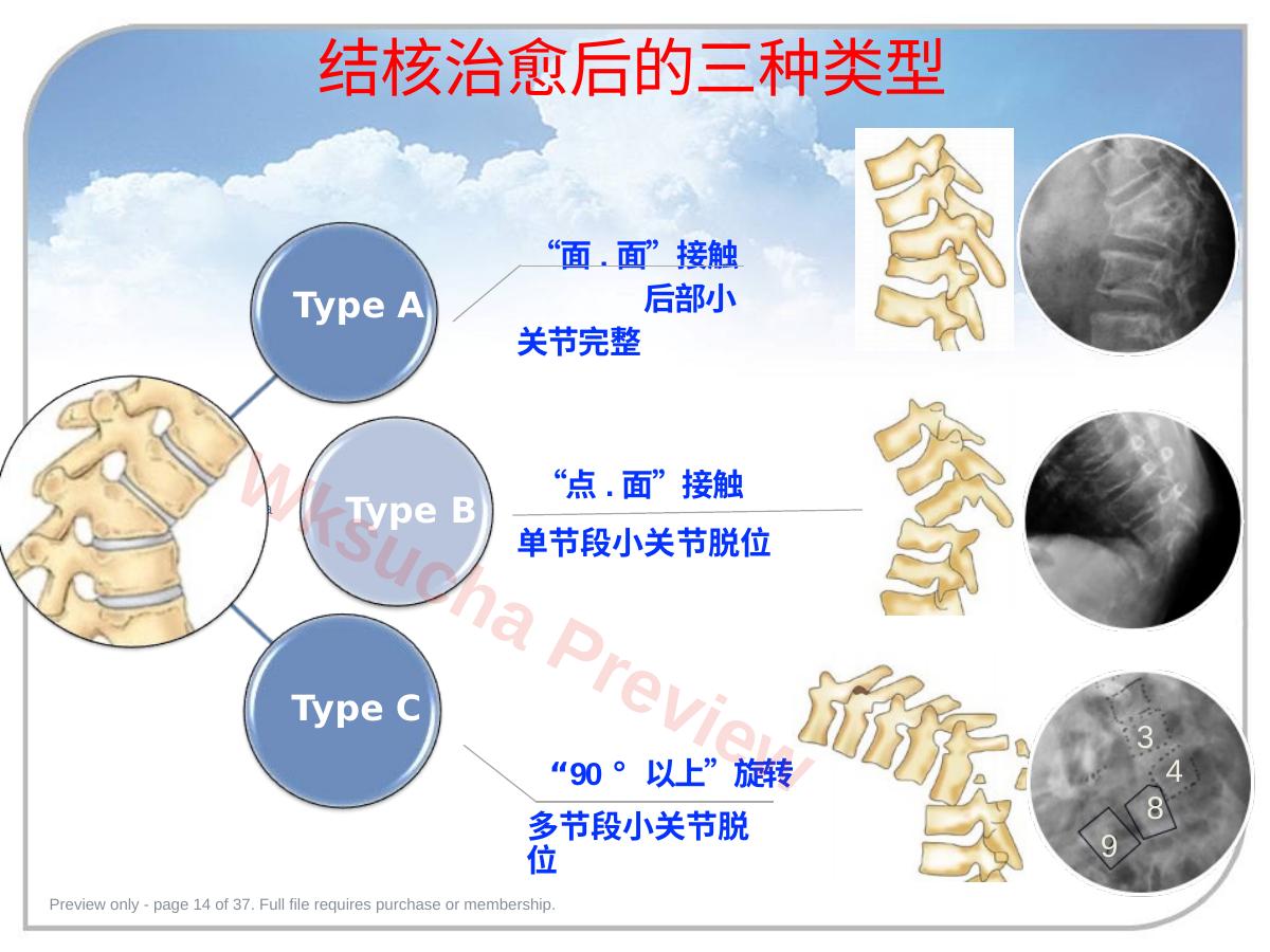 预览第 14 页
