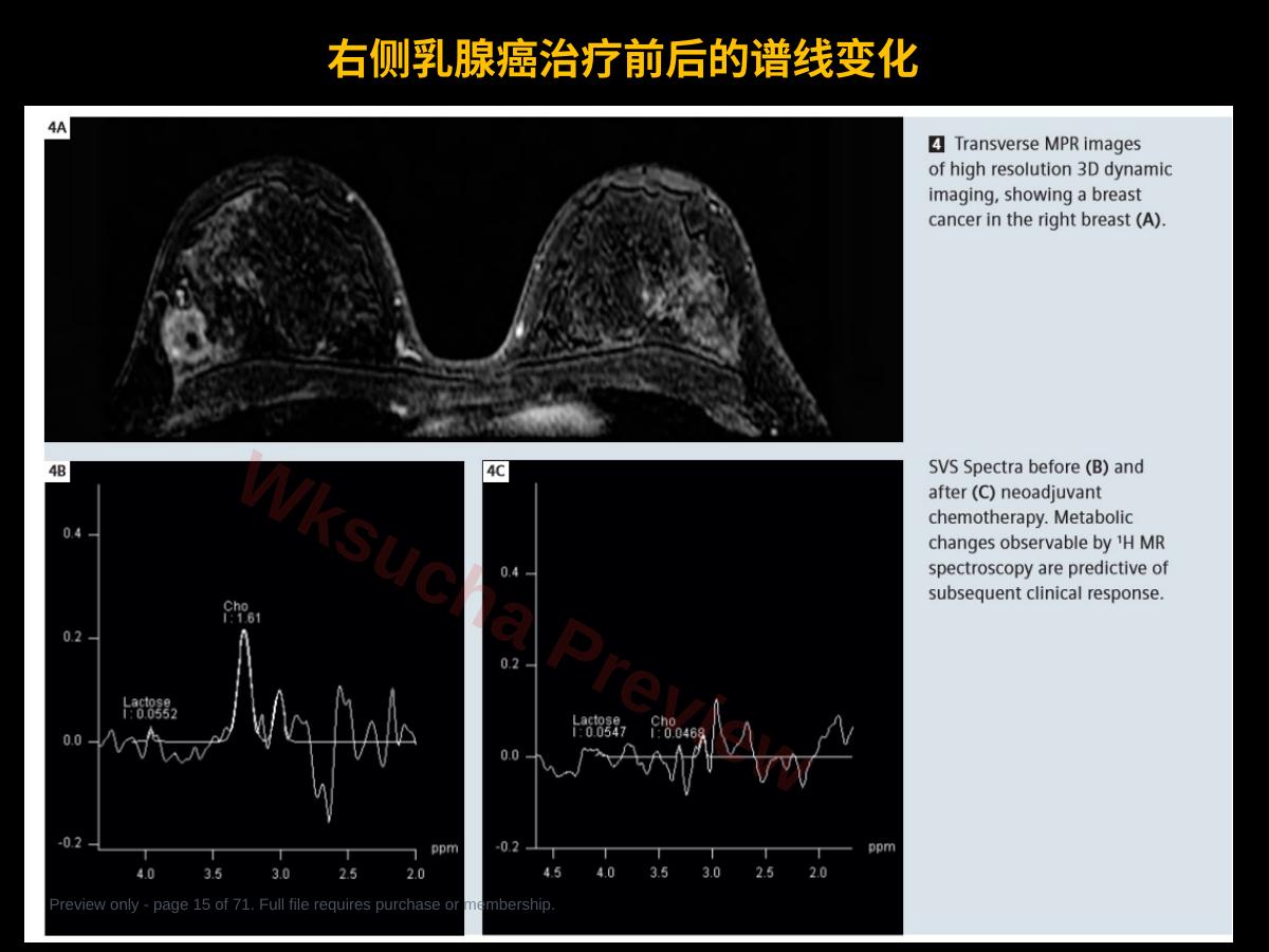 预览第 15 页