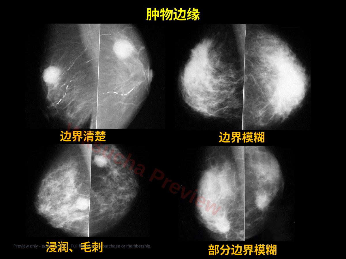 预览第 35 页