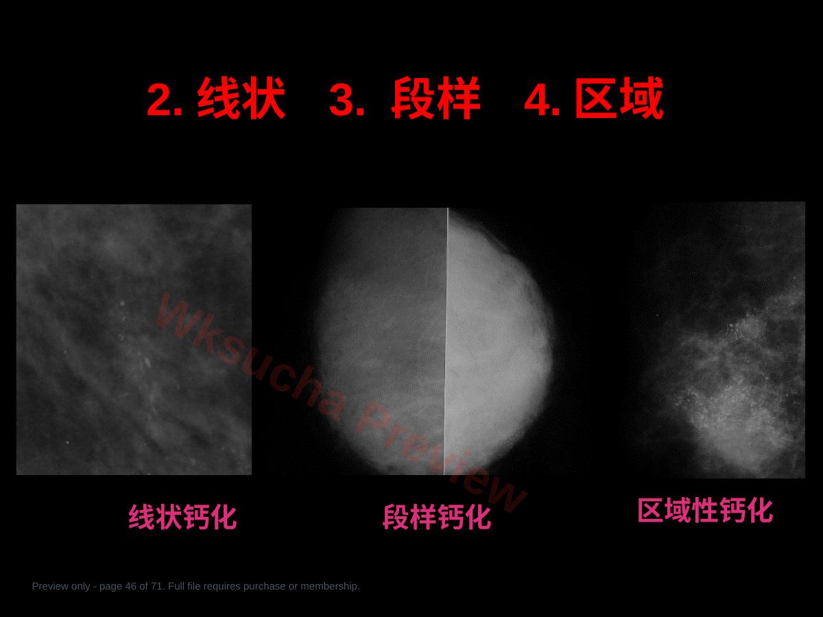 预览第 46 页