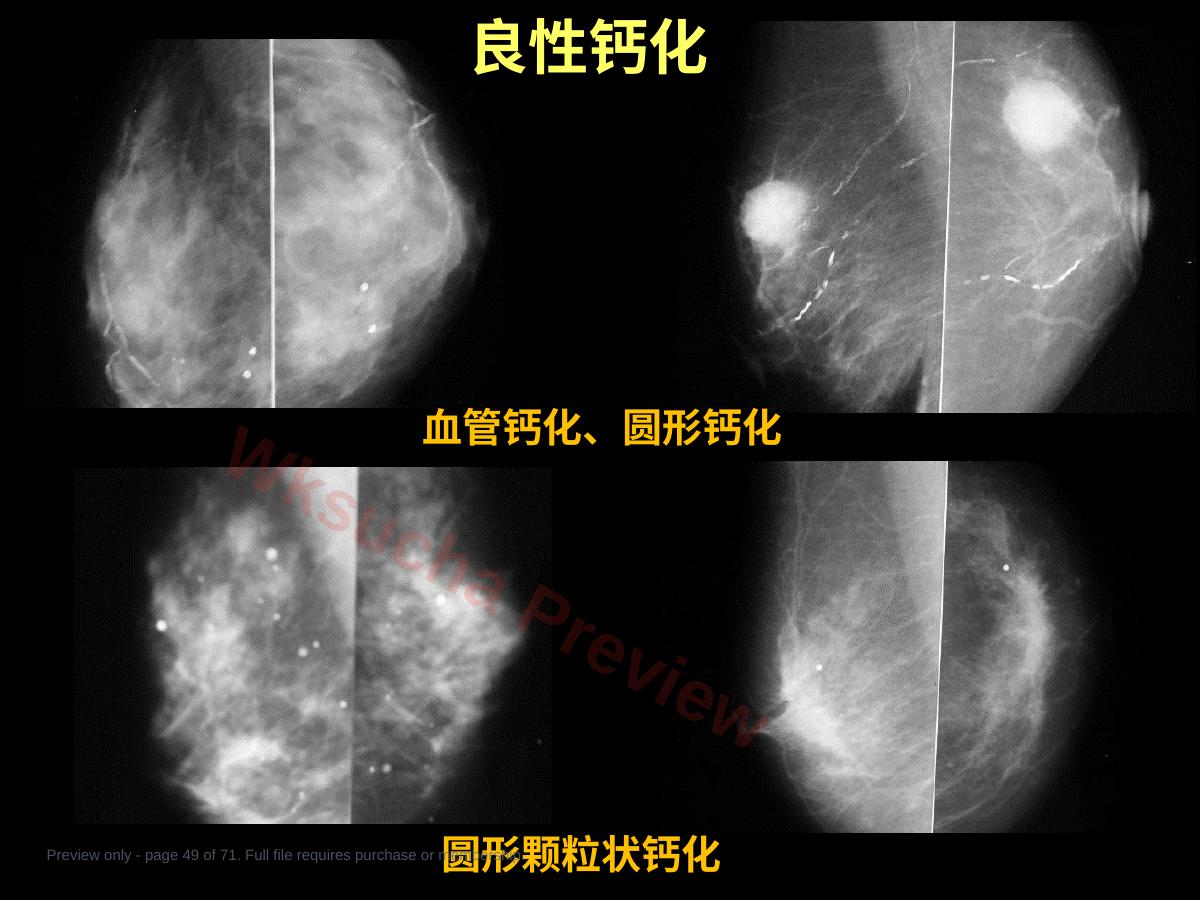 预览第 49 页