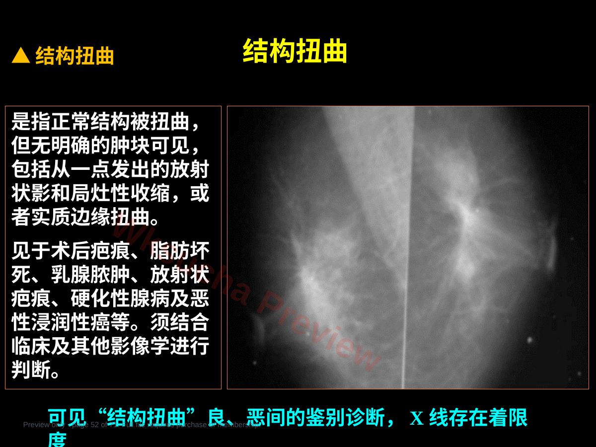 预览第 52 页