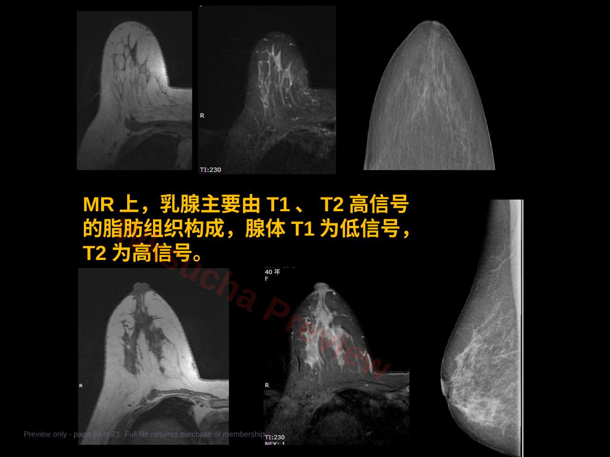 预览第 69 页