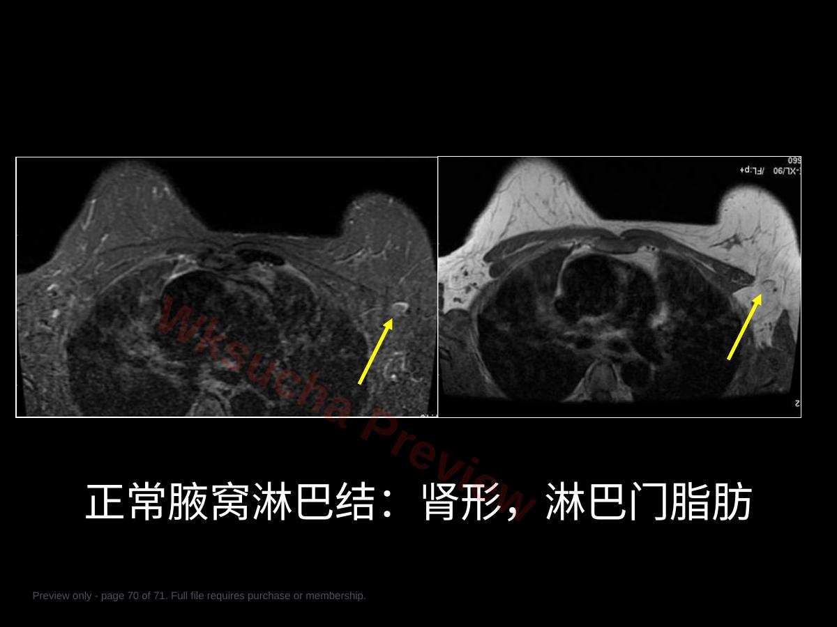 预览第 70 页