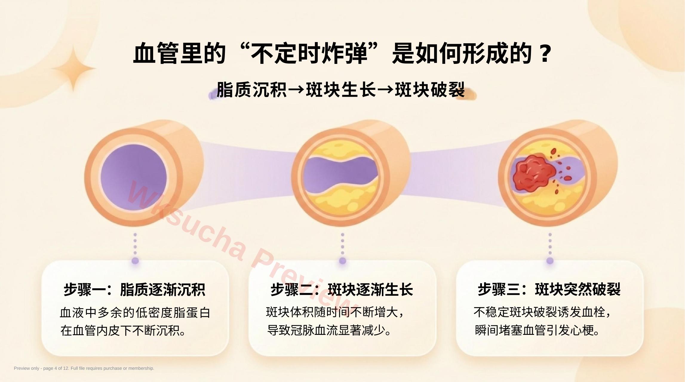 预览第 4 页