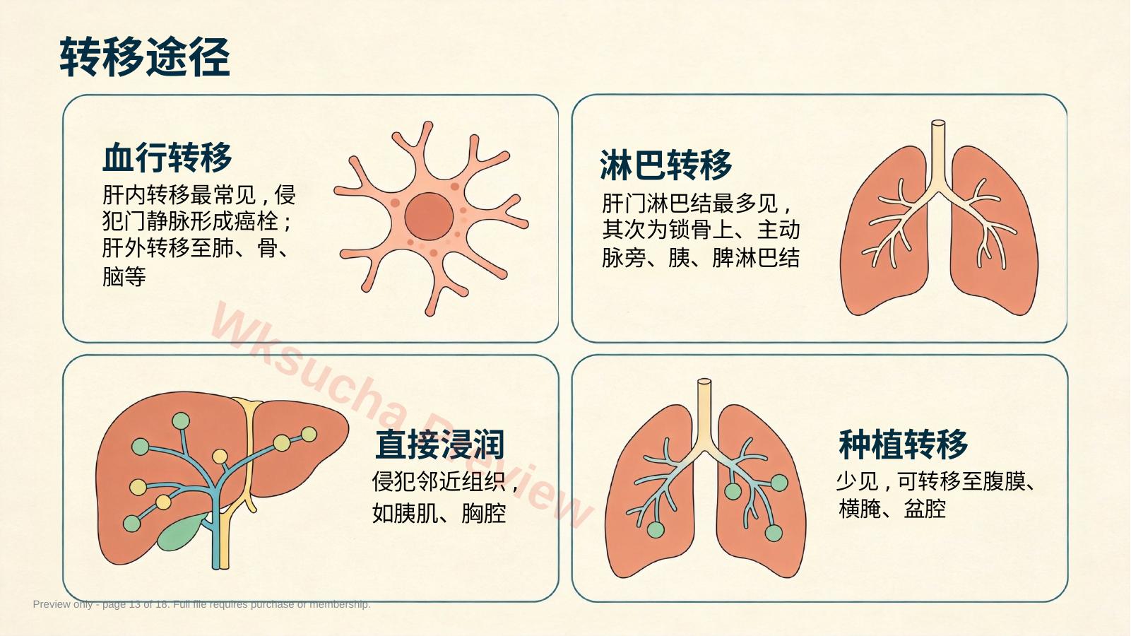 预览第 13 页