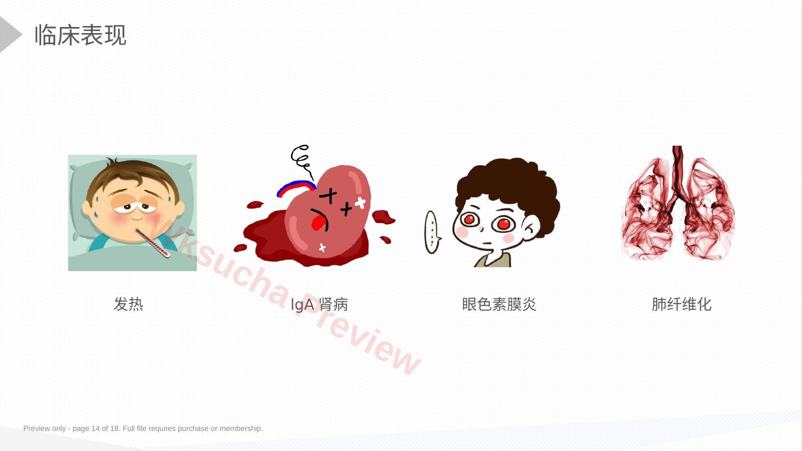 预览第 14 页