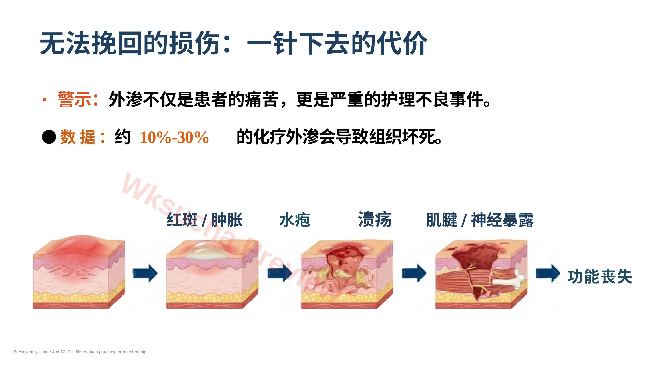 预览第 4 页