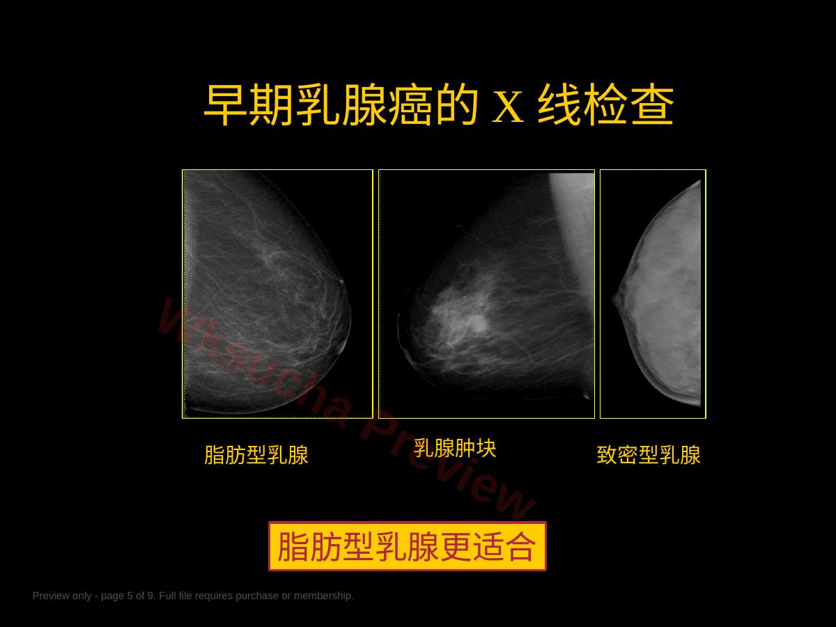 预览第 5 页