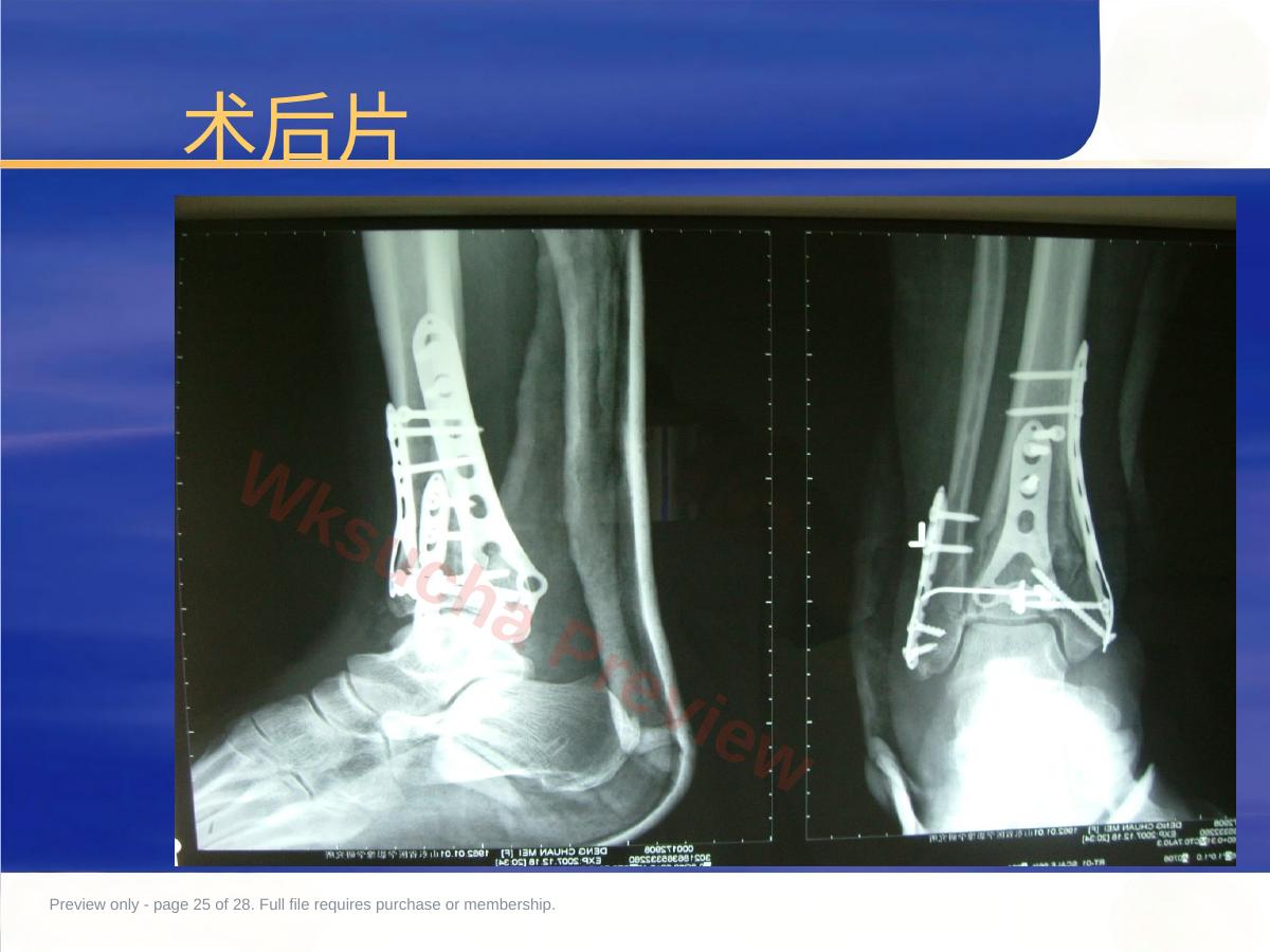 预览第 25 页