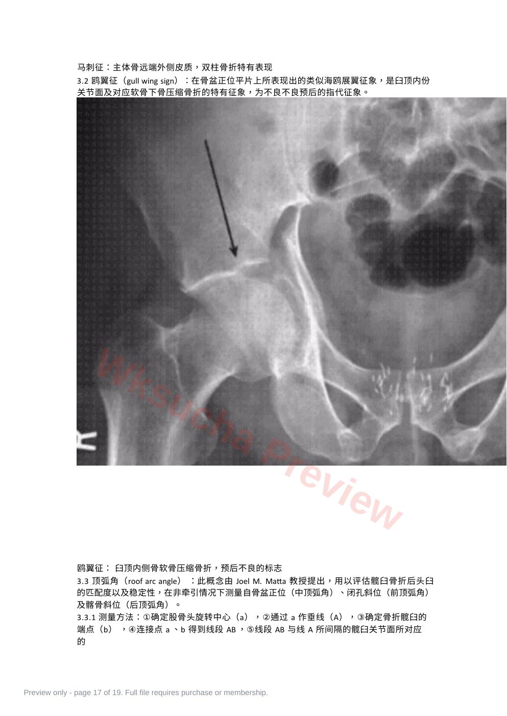 预览第 17 页