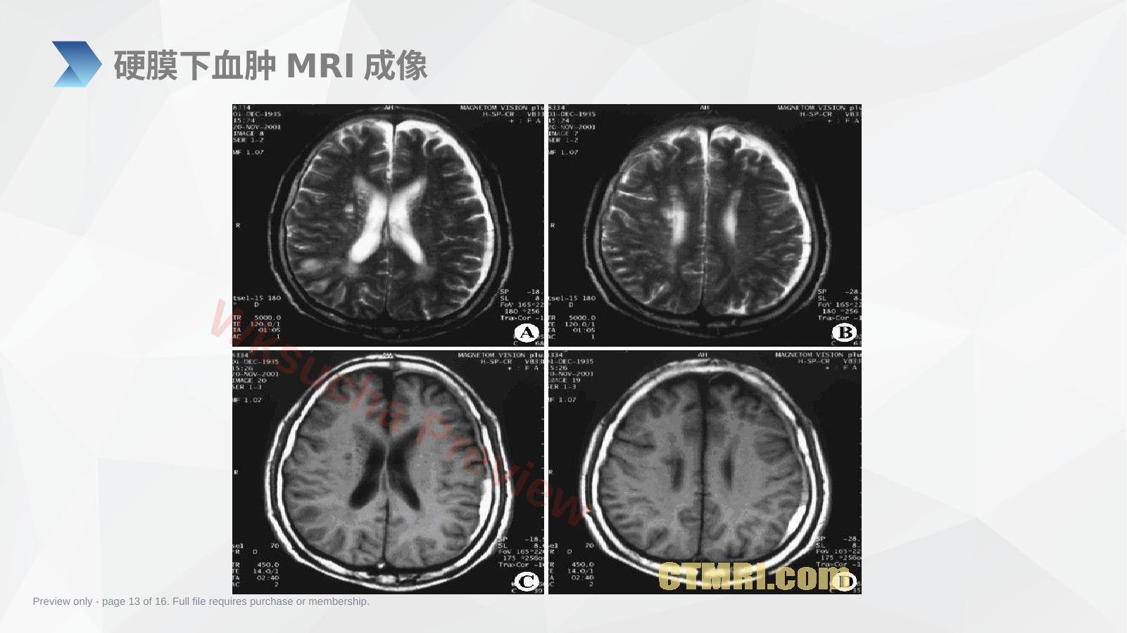 预览第 13 页