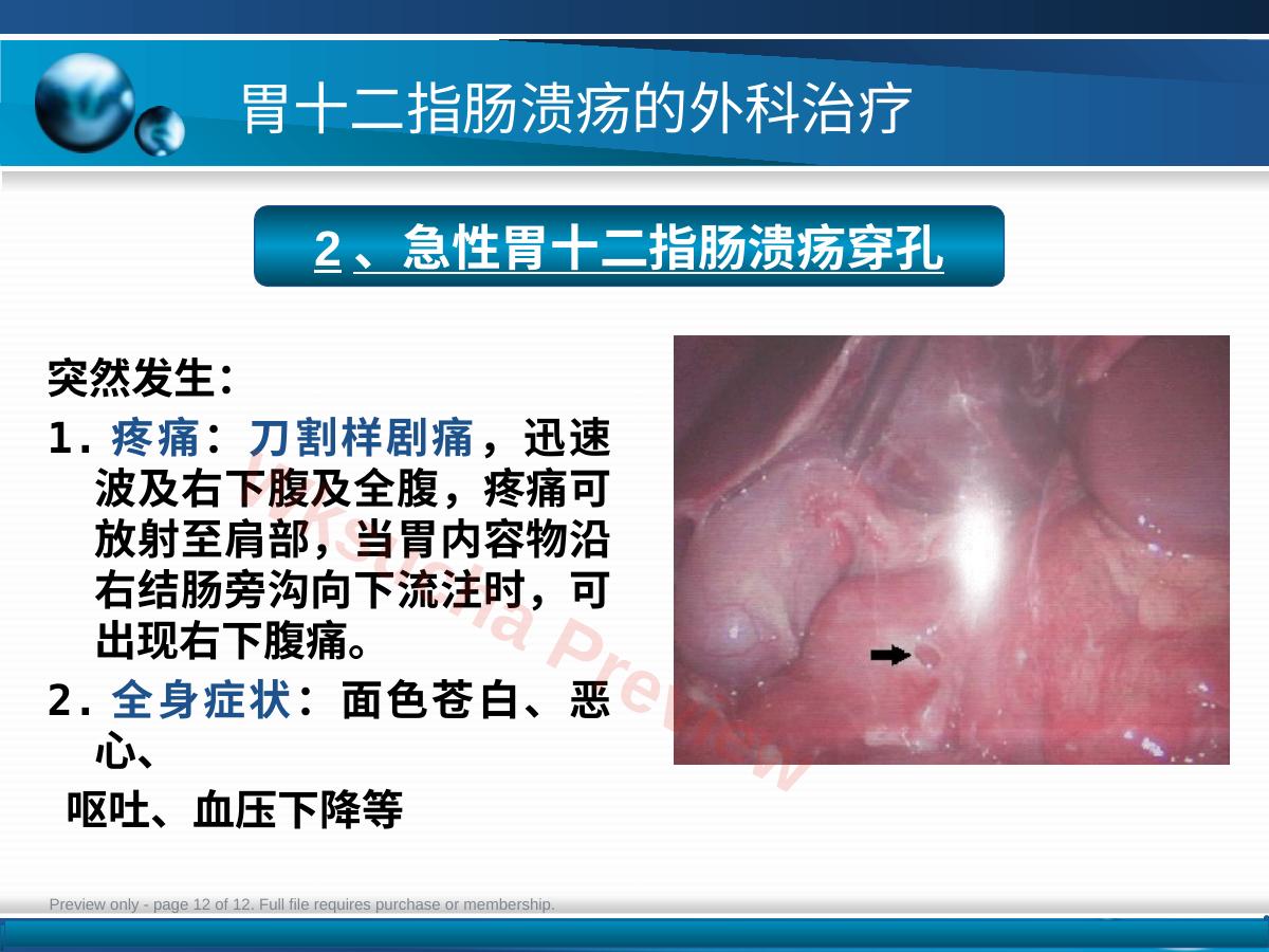 预览第 12 页
