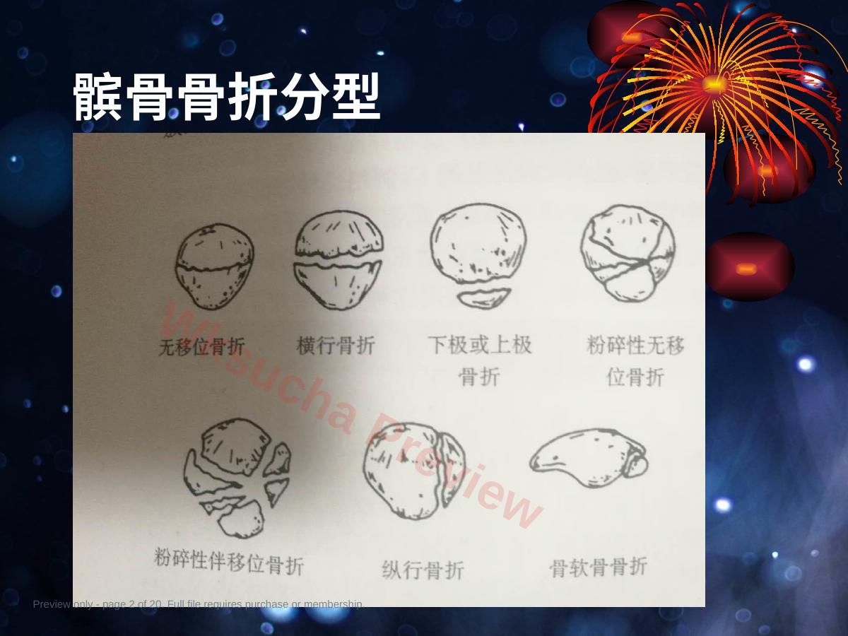 预览第 2 页
