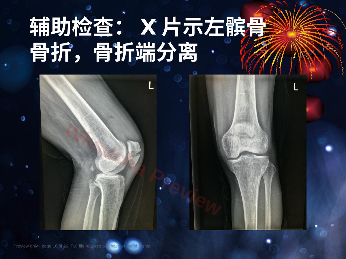 预览第 16 页