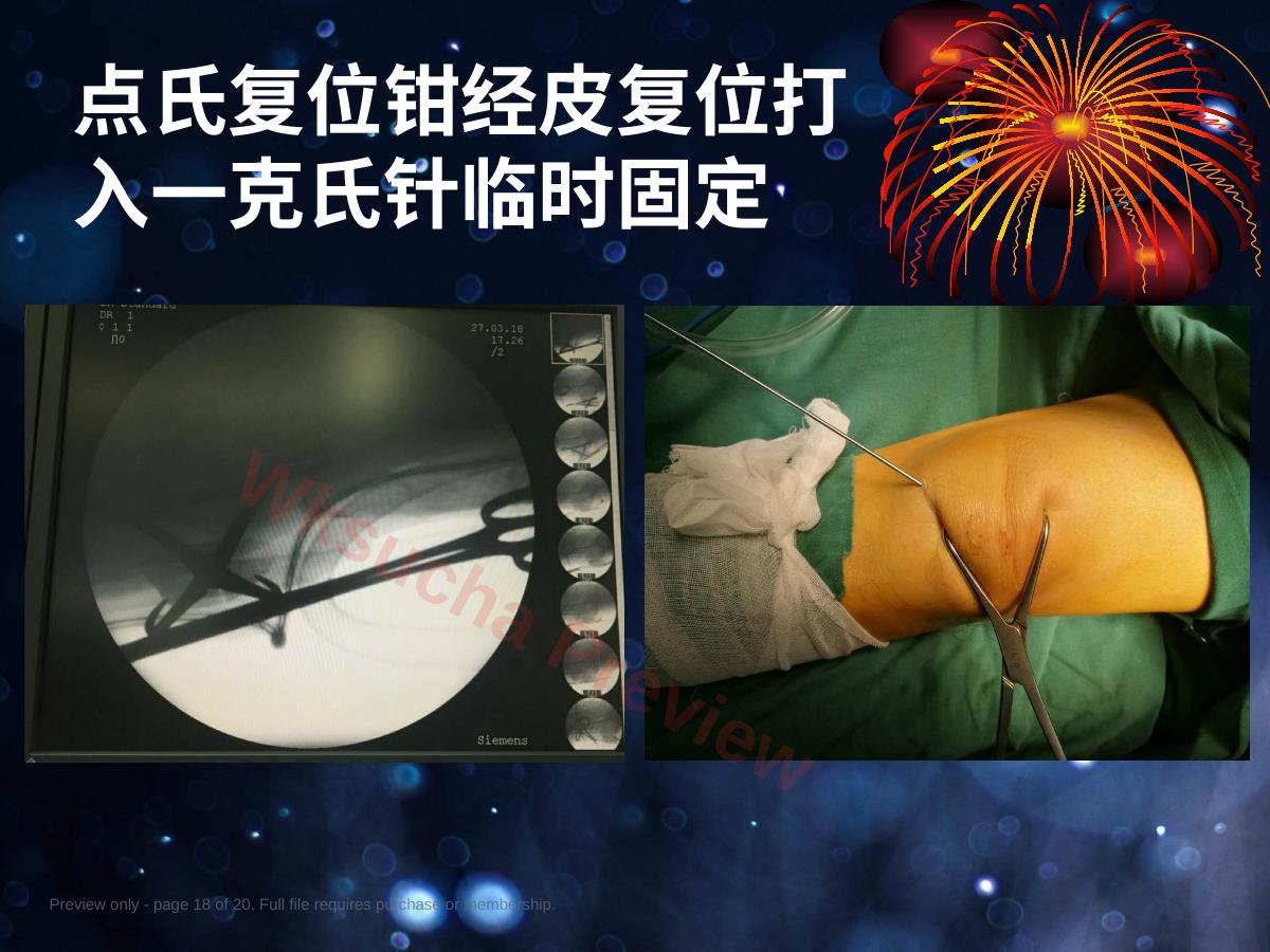 预览第 18 页