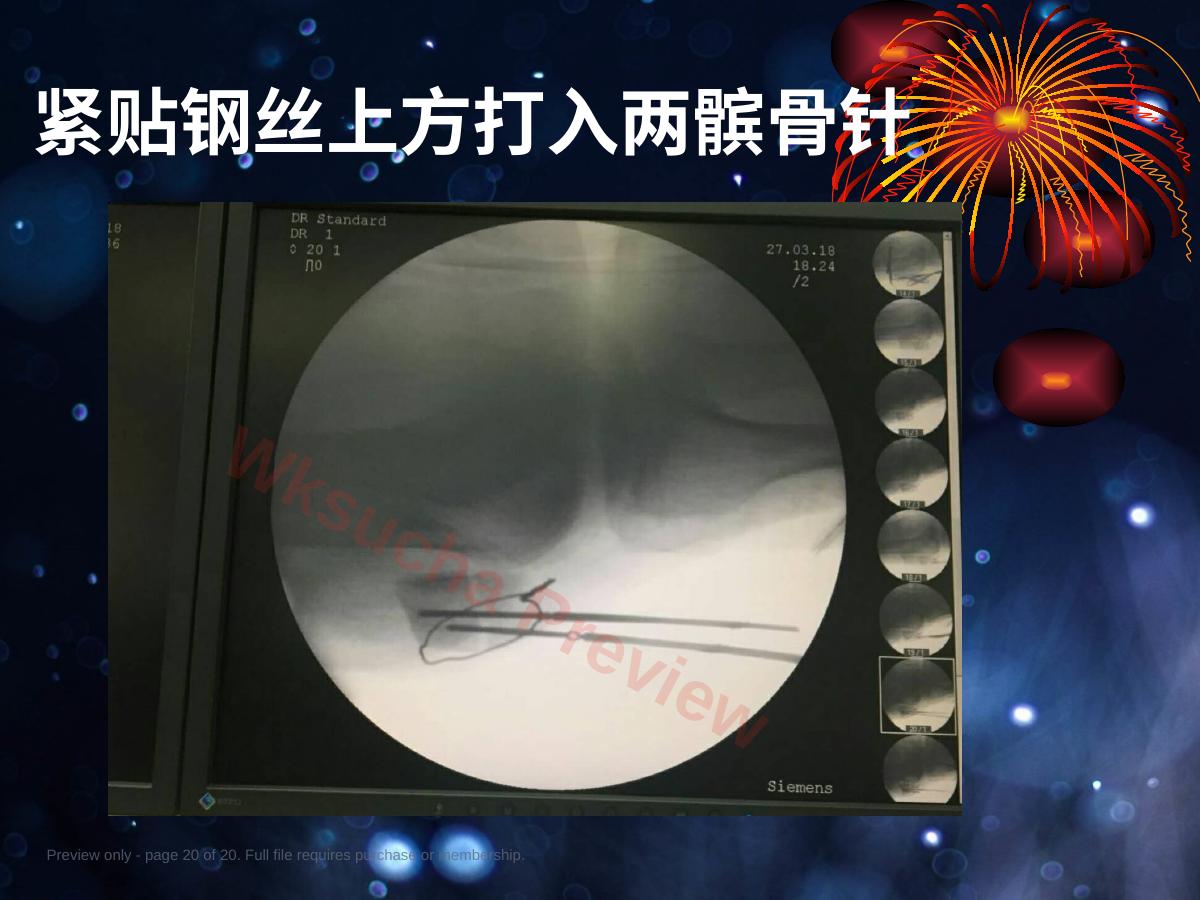 预览第 20 页