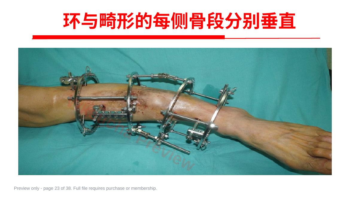 预览第 23 页