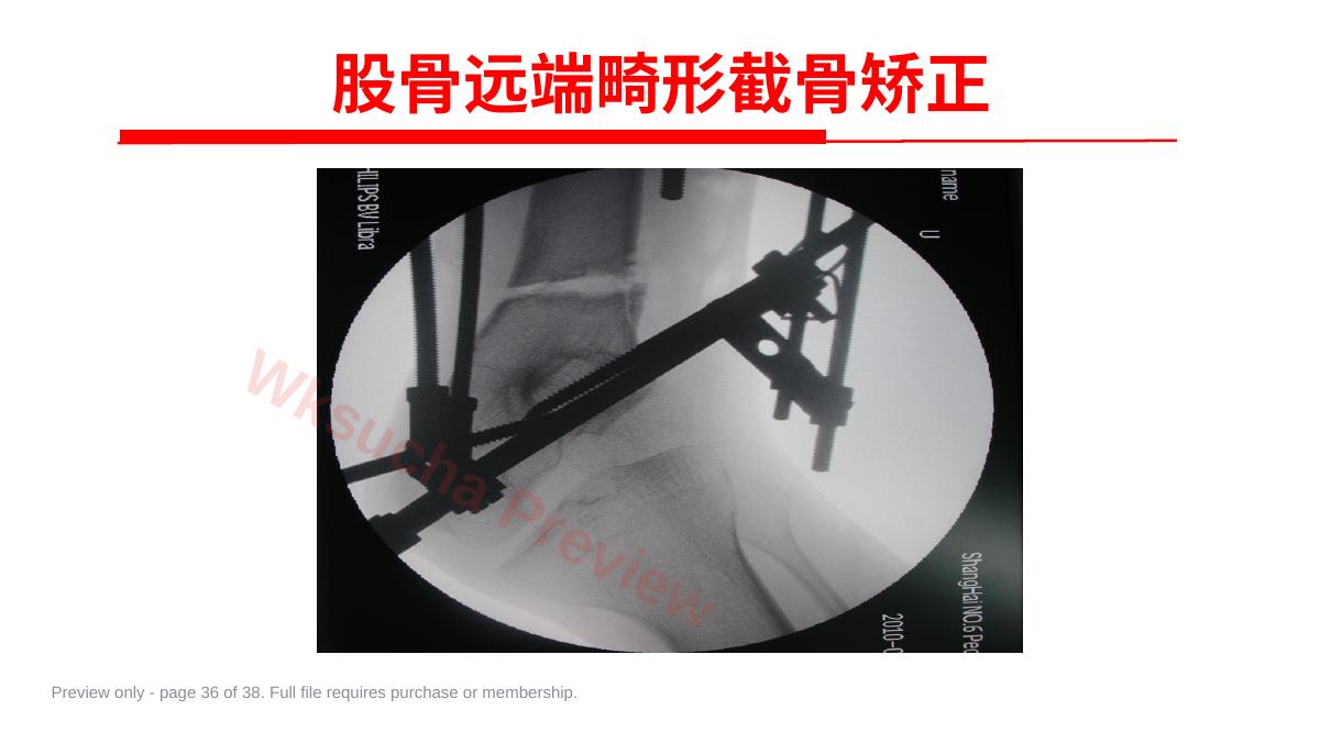 预览第 36 页