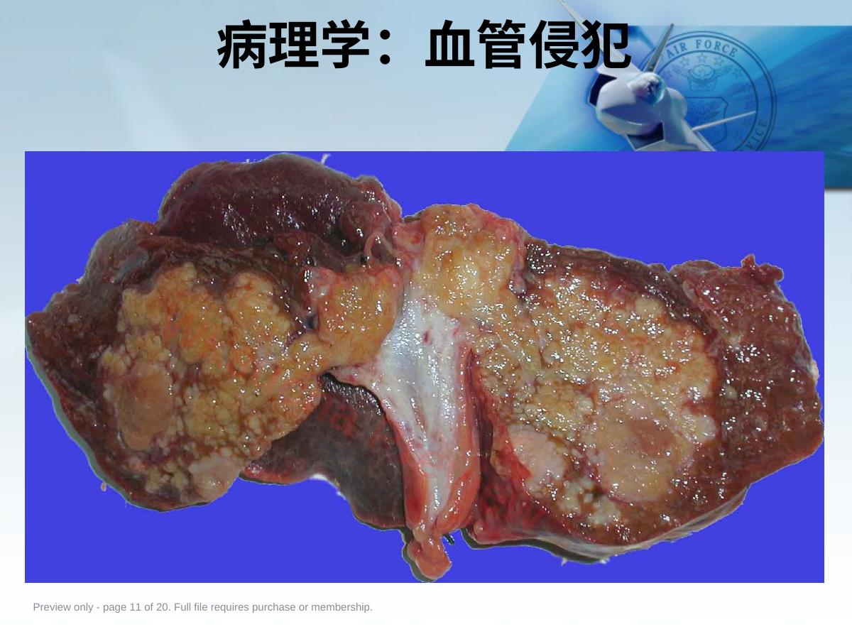 预览第 11 页