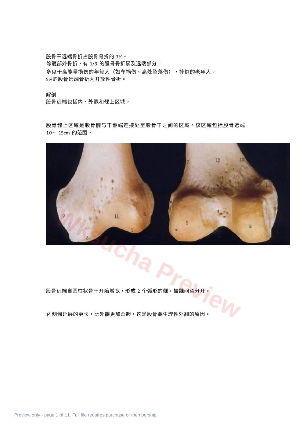 股骨远端骨折---固定方式决定手术成败!