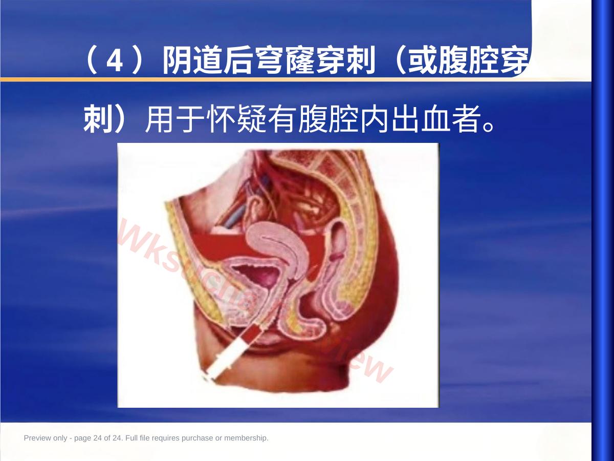 预览第 24 页